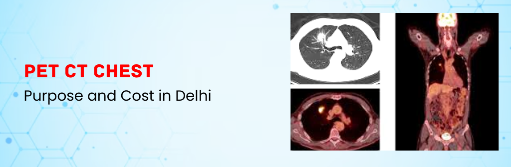  PET CT Chest: Purpose and Cost in Delhi